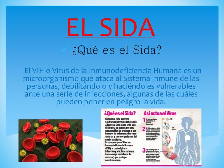 Vih Y Sida Son Lo Mismo Diferencias Cuadro Comparativo