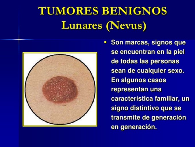 Lunares benignos caracteristicas