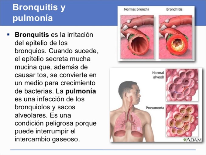 Bronquitis que es