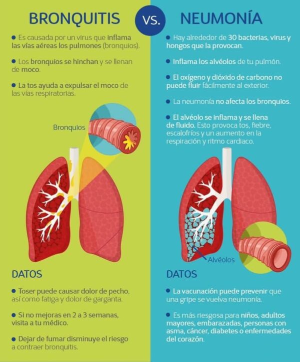 Diferencia Entre Bronquitis Y Neumonia Consultas Medicas Online ...